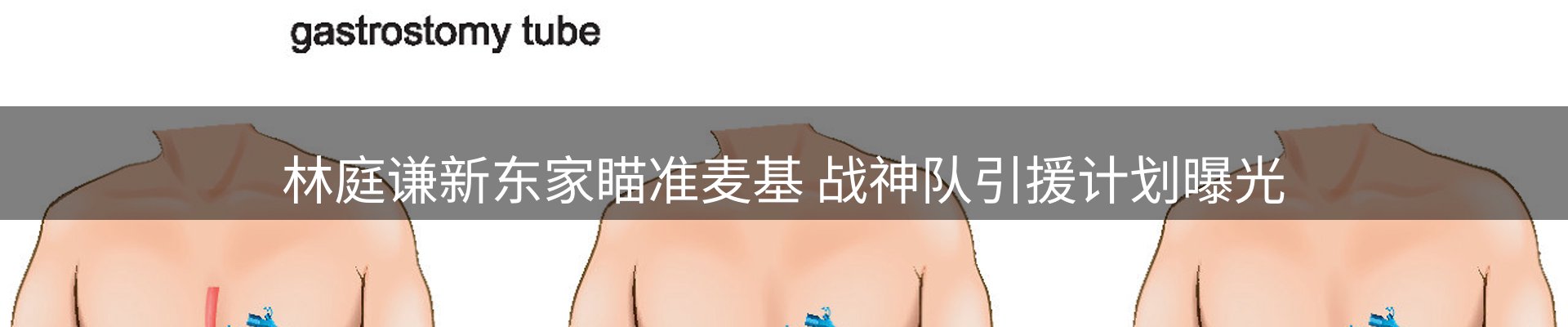 平台播报